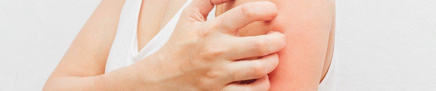 Симптомы и признаки аллергии