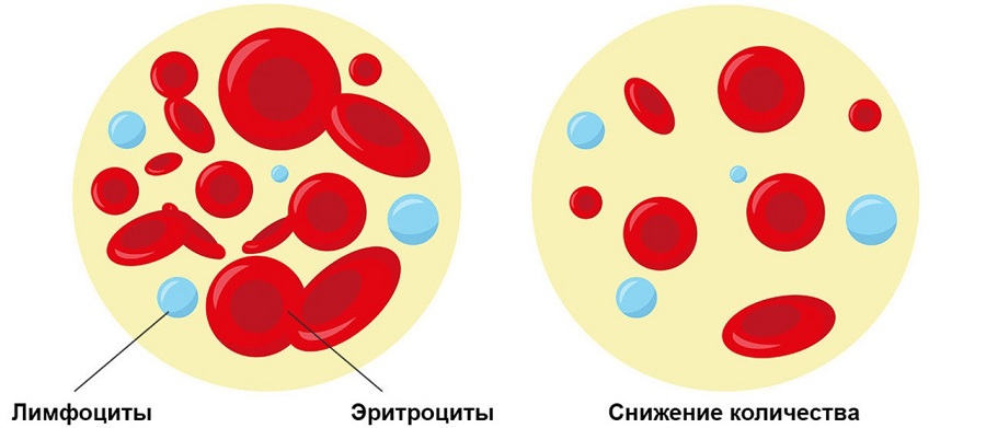 Количество эритроцитов при анемии