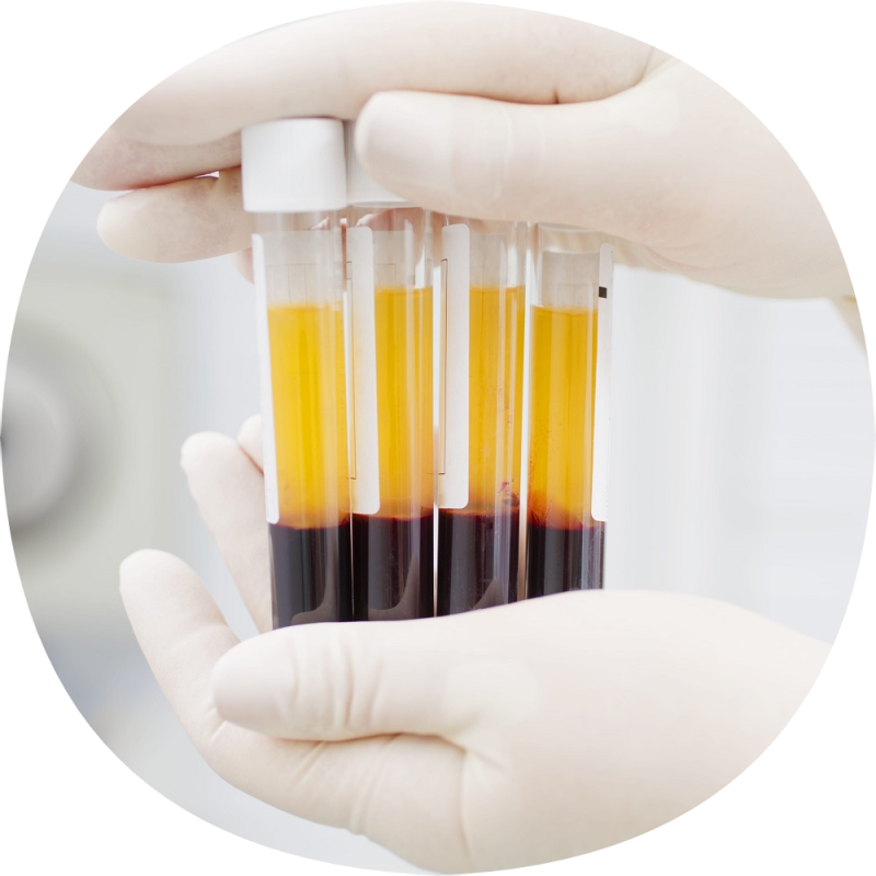 Плазмотерапия в гинекологии