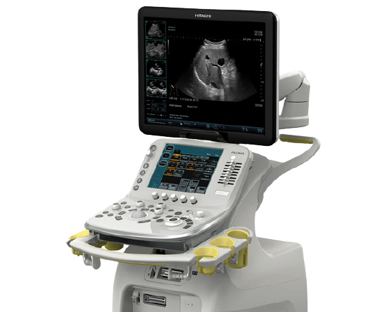 УЗИ мочевыводящих путей