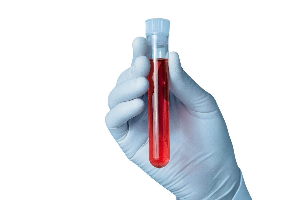 Клинический анализ крови всего за 480 руб